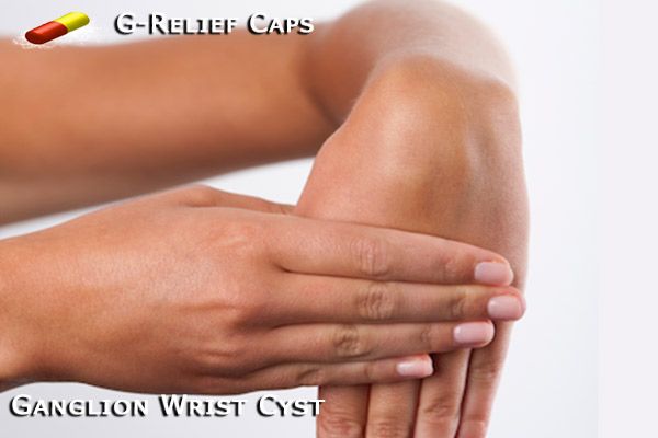G-Relief Caps Natural Remedy for Ganglion Wrist Cysts 