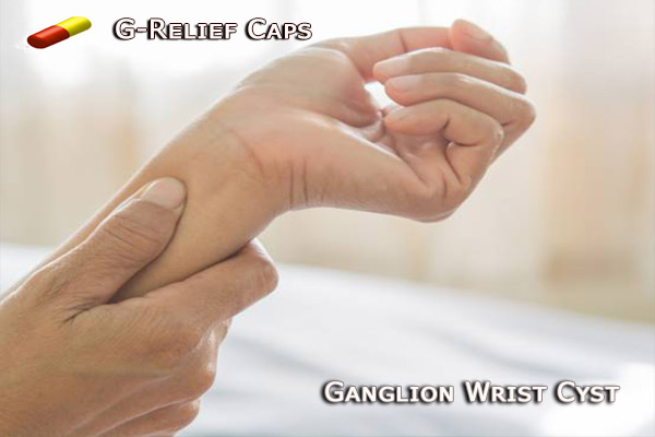 Ganglion Wrist Cyst SURGERY Alternative G-Relief-Caps 100% Natural 0% Recurrence. INFO: g-relief.com